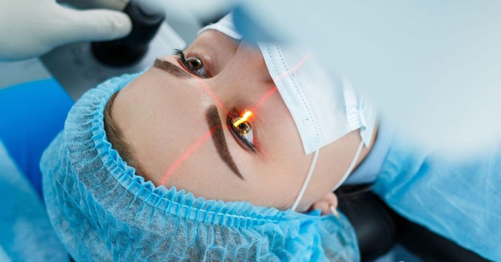 Laser Eye Surgery